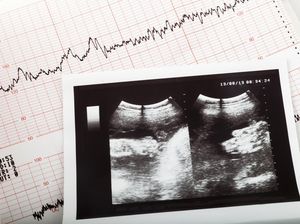 Menanti Tersangka Tewasnya Mahasiswi Hamil di Parepare