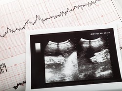 Menanti Tersangka Tewasnya Mahasiswi Hamil di Parepare