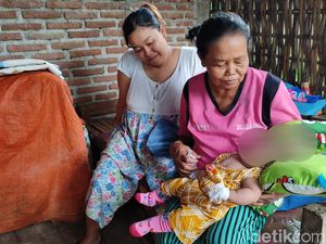 Bayi Tanpa Batok Kepala di Ponorogo Meninggal Dunia Bayi Tanpa Batok Kepala di Ponorogo Meninggal Dunia