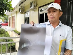 Polisi Periksa Pelapor Dokter RS Murni Teguh Diduga Salah Operasi