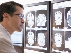 Fujifilm Hadirkan Teknologi AI untuk Industri Kesehatan