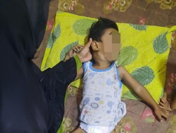 Alhamdulillah, Bocah Pengidap Kanker Getah Bening di Jambi Dapat Bantuan Pengobatan