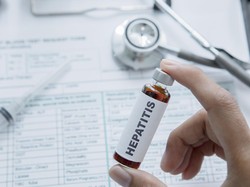 Menkes Sebut Hepatitis Jadi Ancaman, Satu Kelompok dengan TBC-HIV