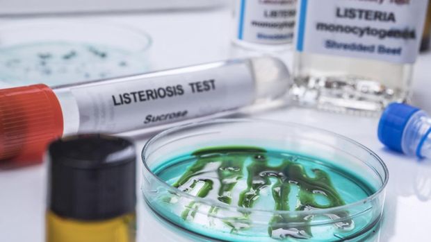 Ilustrasi listeriosis atau listeria