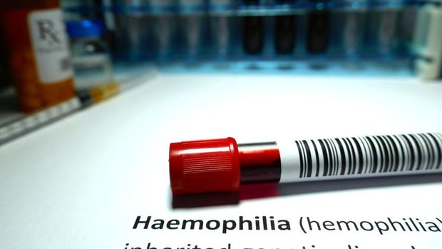 Ilustrasi hemofilia