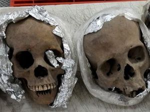 Ngeri! Tengkorak Manusia Ditemukan dalam Paket Tujuan AS