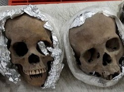 Horor! 4 Tengkorak Manusia Hendak Dipaketkan ke AS