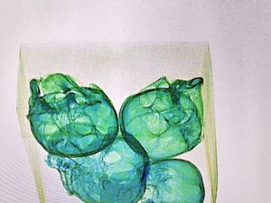 Hiii.. 4 Tengkorak Ditemukan di Dus Paket Bandara Meksiko