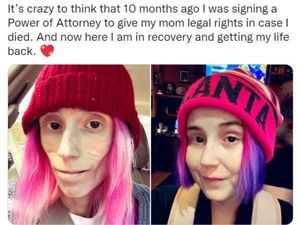 Viral Kisah Wanita Kembali Hidup Usai Miliki Tubuh Terlampau Kurus