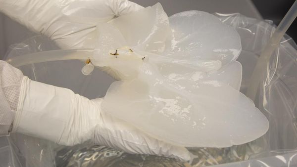 8 Foto Persiapan Ilmuwan Transplantasi Organ Hati-Ginjal Babi ke Manusia