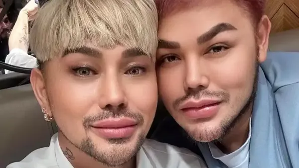 8 Potret Ivan Gunawan & Caren Delano Disebut Mirip Setelah Operasi Plastik