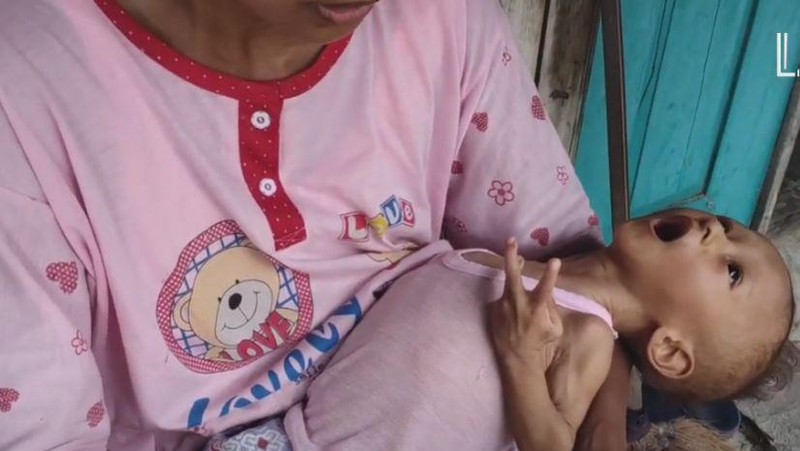 Kurusnya Tubuh Salman Hingga Tak Bisa Tegakkan Leher, Kamu Bisa Bantu