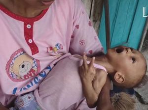 Kurusnya Tubuh Salman Hingga Tak Bisa Tegakkan Leher, Kamu Bisa Bantu