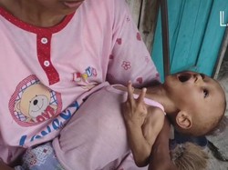 Kurusnya Tubuh Salman Hingga Tak Bisa Tegakkan Leher, Kamu Bisa Bantu