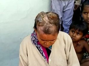 Wanita Ini Muncul Tanduk di Kepalanya, Para Ahli Bingung