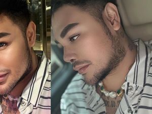 Jajal Oplas di Turki, Ivan Gunawan Harus Pakai Perban Hidung Saat Tidur