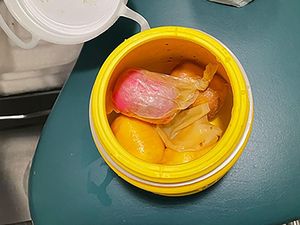 Edan, Turis Nakal Seludupkan Narkoba di Kapsul Mainan Anak-anak