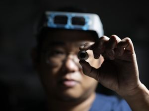 Kisah Rizwan, Jadi Okularis Sejak Anaknya Kehilangan Mata Karena kanker