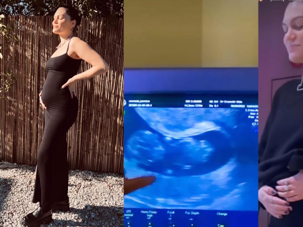 Momen Bahagia Jessie J Pamer Baby Dump, Sempat Keguguran Satu Tahun Lalu Momen Bahagia Jessie J Pamer Baby Dump, Sempat Keguguran Satu Tahun Lalu