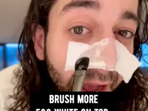 Viral Hilangkan Komedo Pakai Telur, Pakar Kecantikan Menentangnya Viral Hilangkan Komedo Pakai Telur, Pakar Kecantikan Menentangnya