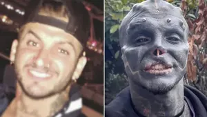 Transformasi Cowok yang Rela Potong Jari Demi Jadi Black Alien