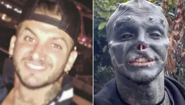 Transformasi Cowok yang Rela Potong Jari Demi Jadi Black Alien