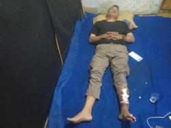 Kaki Membusuk Usai Kecelakaan, Abang Ojol Garut Butuh Pertolongan