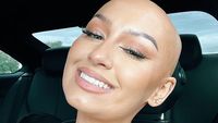 8 Potret Beauty Influencer Berkepala Botak Ingin Dobrak Standar Kecantikan