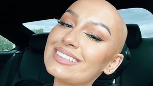 8 Potret Beauty Influencer Berkepala Botak Ingin Dobrak Standar Kecantikan