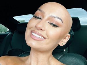 8 Potret Beauty Influencer Berkepala Botak Ingin Dobrak Standar Kecantikan