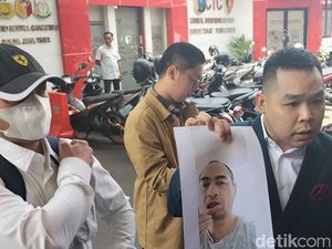 Blak-blakan Ferry Irawan Soal Hidung Venna Melinda Mengucurkan Darah