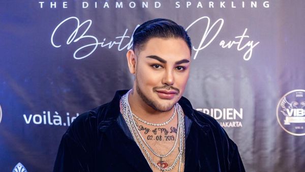 8 Foto Wajah Baru Ivan Gunawan Usai Oplas Hidung, Disebut Mirip Aktor Turki