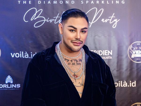 8 Foto Wajah Baru Ivan Gunawan Usai Oplas Hidung, Disebut Mirip Aktor Turki