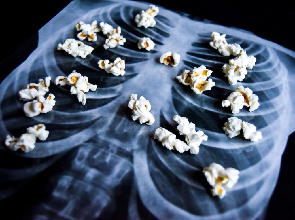 Apa Itu Popcorn Lung? Dialami Wanita yang Hobi Nge-vape Berujung Paru Kolaps Apa Itu Popcorn Lung? Dialami Wanita yang Hobi Nge-vape Berujung Paru Kolaps