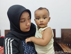 Ibu dan Anak 16 Bulan di Surabaya Jatuh hingga Terseret gegara Ulah Jambret