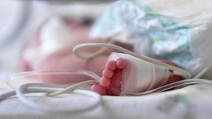 Kisah Bayi 4 Hari Tak Buang Air Kecil, Ternyata Kena Gagal Ginjal Akut