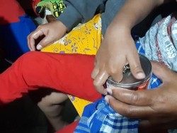 Jari Bocah Jaktim Terjepit di Lubang Kaleng Susu, Ortu Minta Bantuan Damkar