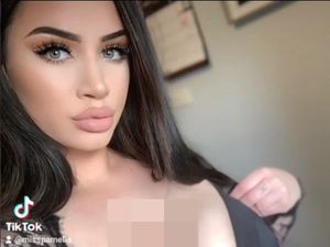 Wanita Idap Gigantomastia, Payudara Tak Berhenti Tumbuh Berakhir Seperti Ini Wanita Idap Gigantomastia, Payudara Tak Berhenti Tumbuh Berakhir Seperti Ini