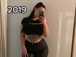 Wanita Alami Kondisi Langka dengan Payudara Terus Tumbuh di Usia 27 Tahun