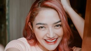 7 Foto Siti Badriah Makin Cantik Dengan Veneer & Filler Bibir, Dituding Oplas