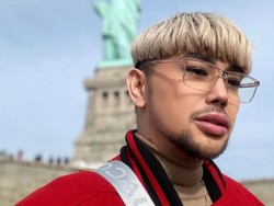 5 Fakta Caren Delano yang Disebut Mirip Ivan Gunawan Setelah Operasi Plastik