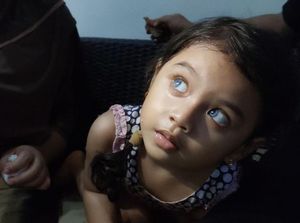 Mari Bantu Zahida, Bocah Penderita Kelainan Penglihatan