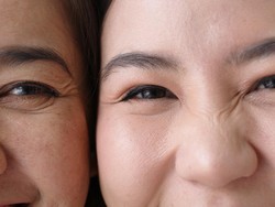 Ternyata, Lubang Hidung Kanan-Kiri Mencium Bau dengan Cara Berbeda