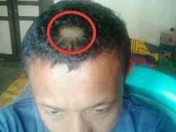 Komisi X DPR Kecam Ortu Balas Cukur Pitak Rambut Guru di Gorontalo