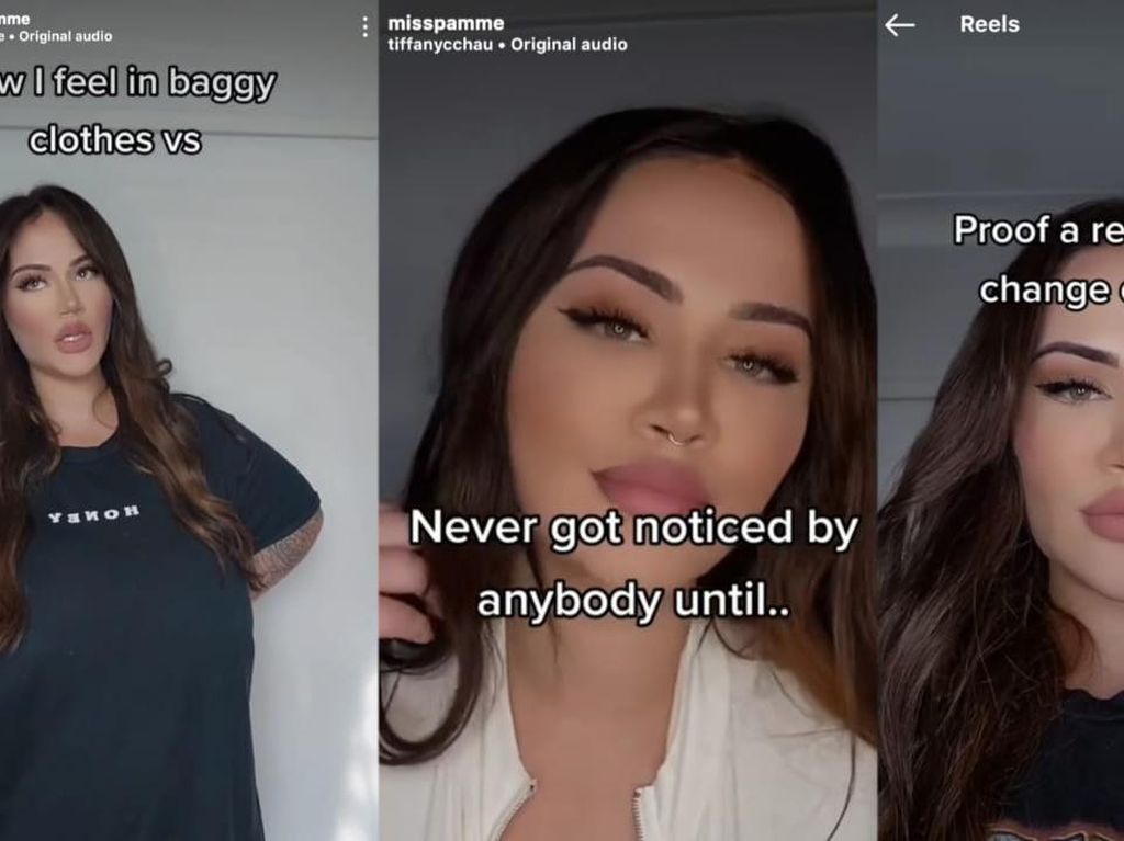 Deretan Kasus Wanita Alami Payudara Tak Berhenti Tumbuh gegara Kondisi Langka Deretan Kasus Wanita Alami Payudara Tak Berhenti Tumbuh gegara Kondisi Langka