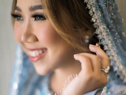 Bikin Heboh! Curhatan Kiky Saputri soal Stroke Telinga-Faskes Indonesia di Cuitan Jokowi