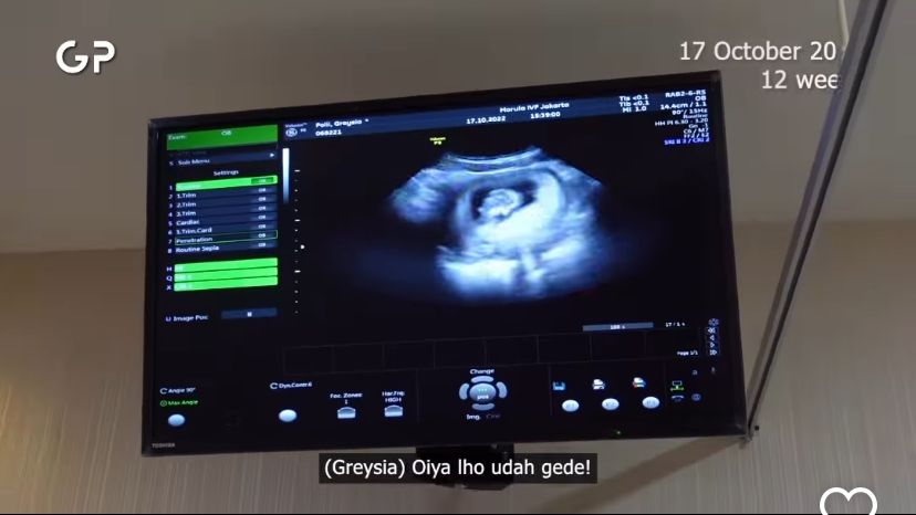 Greysia Polii dan Suami Umumkan Kehamilan Pertama Greysia Polii dan Suami Umumkan Kehamilan Pertama