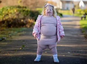 Viral Bocah 5 Tahun Tak Bisa Berhenti Makan, BB-nya Sudah 45 Kg