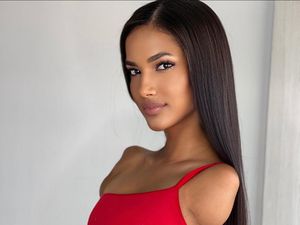Kisah Wanita dengan Satu Kaki dan Tanpa Lengan Sukses Raih Mimpi Jadi Model Kisah Wanita dengan Satu Kaki dan Tanpa Lengan Sukses Raih Mimpi Jadi Model