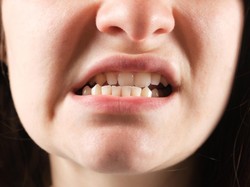 Viral Istilah Mewing di Medsos, Termasuk Operasi Plastik? Ini Penjelasannya